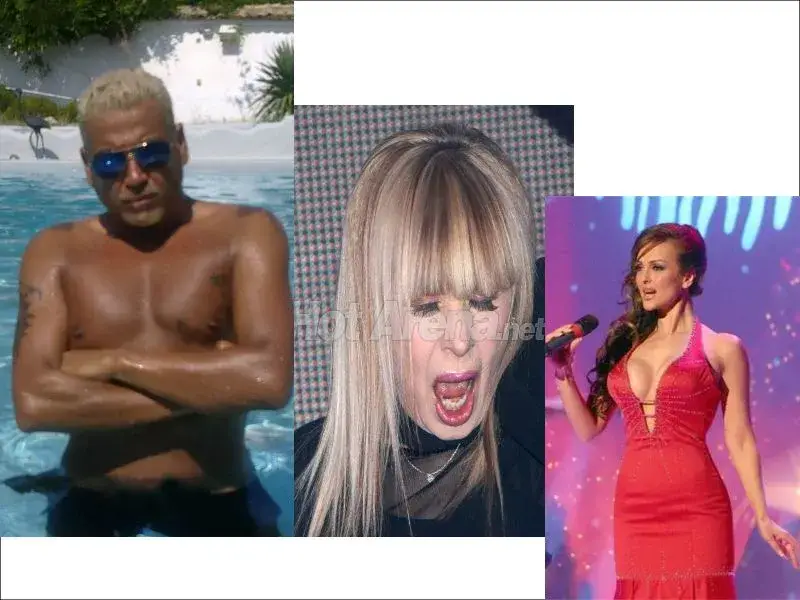 Топ 3 на най-странните пластични операции на бг звездите! (И ОПАСНИ!)