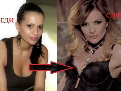 БЕЗГЪРДИЕ мори Преслава! 40 см от обиколката се стопиха за нула време (Обмисля повторна операция + СНИМКИ)