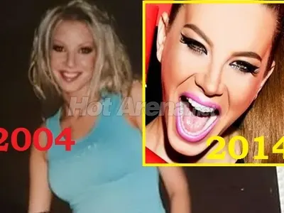 Как се промени Емилия през годините? (Леки и по-сериозни козметични операции - ПОДРОБНО)