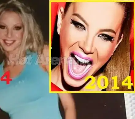 Как се промени Емилия през годините? (Леки и по-сериозни козметични операции - ПОДРОБНО)