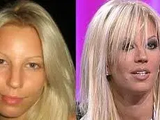 Как се промени Емилия през годините? (Леки и по-сериозни козметични операции - ПОДРОБНО)