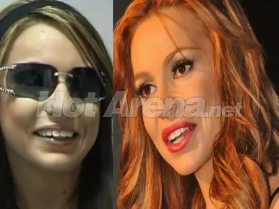 Ето го рекорда! Алисия с лице за 50 бона, корекциите започват да й пречат! (СНИМКИ)