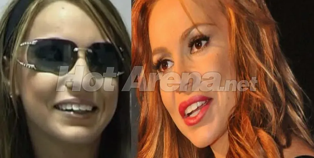 Ето го рекорда! Алисия с лице за 50 бона, корекциите започват да й пречат! (СНИМКИ)