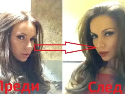 Ето го рекорда! Алисия с лице за 50 бона, корекциите започват да й пречат! (СНИМКИ)