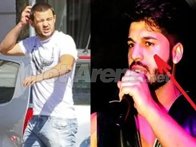 Фики Стораро праща биячи на Бирмата заради побоя! Вижте певеца с насинено око