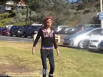 Актриса с драматичен видеоапел: Тежа 18 килограма, ПОМОГНЕТЕ! (Потресаващи снимки в галерията на анорексичката)