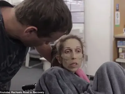 Актриса с драматичен видеоапел: Тежа 18 килограма, ПОМОГНЕТЕ! (Потресаващи снимки в галерията на анорексичката)