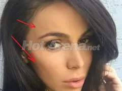 Алисия бори пачи крак с ударни количества ботокс! Получава ли й се? (Цялото й лице е на буци - СНИМКИ)