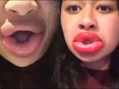 Не е за слаби нерви! Девойки се обезобразяват заради Кайли Дженър (Новата мания побърка нета)