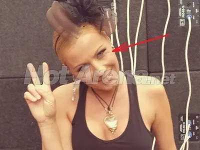 Спешно, потърсете й хирург! Какво се случва с лицето на Камелия?