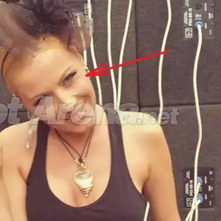 Спешно, потърсете й хирург! Какво се случва с лицето на Камелия?