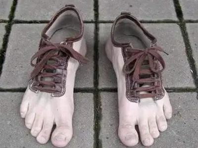 Три пациентки в болнца след носене на отровни боти (Прашките водят до безплодие, подробности и за силикона)