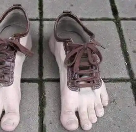 Три пациентки в болнца след носене на отровни боти (Прашките водят до безплодие, подробности и за силикона)