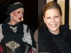 Ето кои известни българки се обезобразиха „благодарение“ на пластичната хирургия! (Шок снимки)