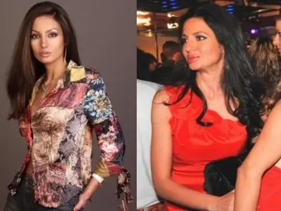 Ето кои известни българки се обезобразиха „благодарение“ на пластичната хирургия! (Шок снимки)