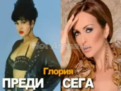 Ето кои известни българки се обезобразиха „благодарение“ на пластичната хирургия! (Шок снимки)