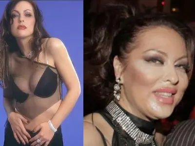 Ето кои известни българки се обезобразиха „благодарение“ на пластичната хирургия! (Шок снимки)