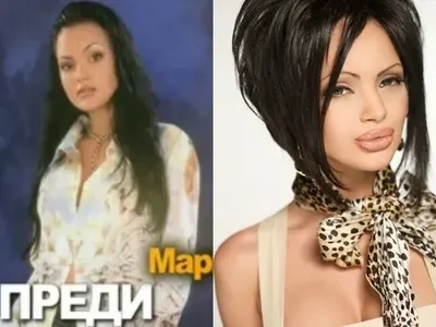 Ето кои известни българки се обезобразиха „благодарение“ на пластичната хирургия! (Шок снимки)