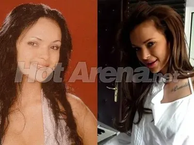 Родните звезди пръскат милиони за корекции! Вижте как са изглеждали преди и колко са вложили! (СНИМКИ)