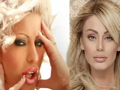 Родните звезди пръскат милиони за корекции! Вижте как са изглеждали преди и колко са вложили! (СНИМКИ)