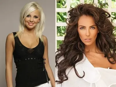 Родните звезди пръскат милиони за корекции! Вижте как са изглеждали преди и колко са вложили! (СНИМКИ)