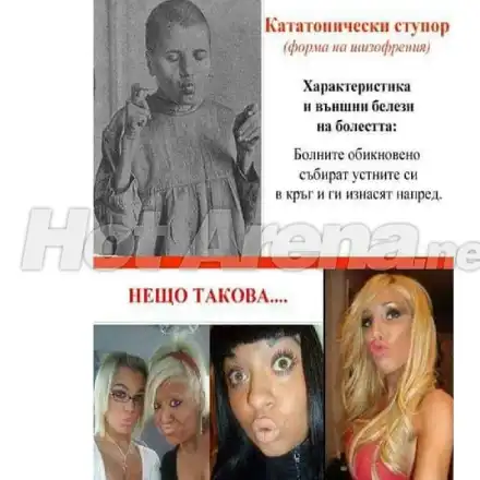 Страдат ли родните звезди от форма на шизофрения? (Тези снимки ще ви накарат да се замислите)