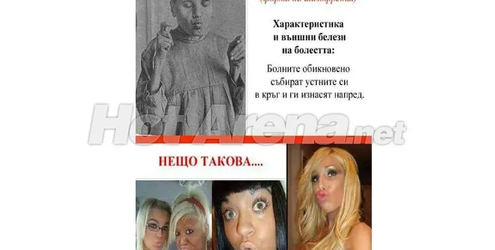 Страдат ли родните звезди от форма на шизофрения? (Тези снимки ще ви накарат да се замислите)