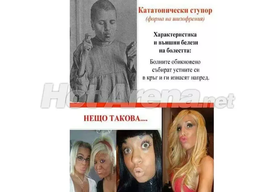 Страдат ли родните звезди от форма на шизофрения? (Тези снимки ще ви накарат да се замислите)