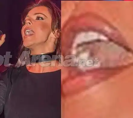 Галена пръсна 50 бона за зъби! Вижте новата й усмивка!