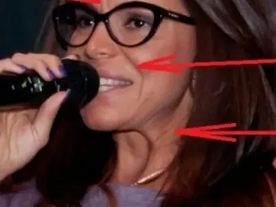 Алисия с лице назаем! Обявиха я за Майкъл Джексън на фолка заради 7 операции на лицето (СНИМКИ)