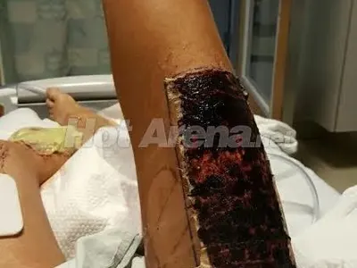 Първо в HotArenа! Ето ги всички снимки на Джино след жестоката катастрофа, от която оцеля на косъм! 12 брутални фотоса! (Предупреждаваме, по-добре не отваряйте тази статия)