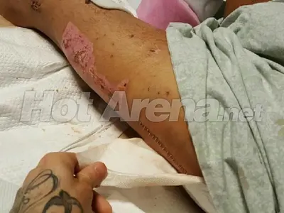 Първо в HotArenа! Ето ги всички снимки на Джино след жестоката катастрофа, от която оцеля на косъм! 12 брутални фотоса! (Предупреждаваме, по-добре не отваряйте тази статия)