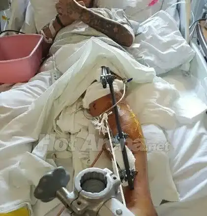 Първо в HotArenа! Ето ги всички снимки на Джино след жестоката катастрофа, от която оцеля на косъм! 12 брутални фотоса! (Предупреждаваме, по-добре не отваряйте тази статия)