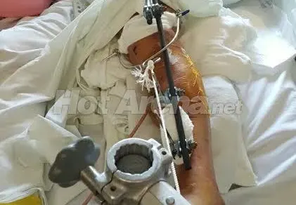 Първо в HotArenа! Ето ги всички снимки на Джино след жестоката катастрофа, от която оцеля на косъм! 12 брутални фотоса! (Предупреждаваме, по-добре не отваряйте тази статия)