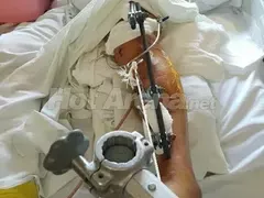 Първо в HotArenа! Ето ги всички снимки на Джино след жестоката катастрофа, от която оцеля на косъм! 12 брутални фотоса! (Предупреждаваме, по-добре не отваряйте тази статия)
