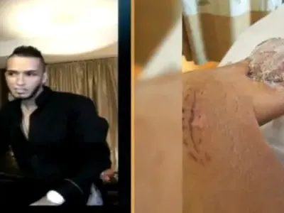 Оперират Джино за девети път (Брутални снимки от инвалидната количка)