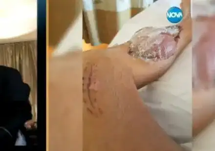 Оперират Джино за девети път (Брутални снимки от инвалидната количка)