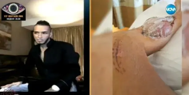 Оперират Джино за девети път (Брутални снимки от инвалидната количка)