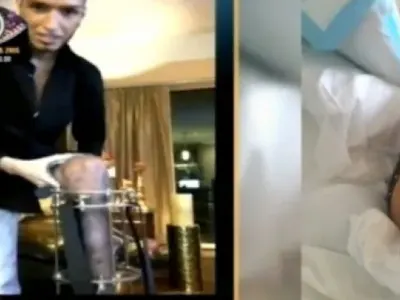 Оперират Джино за девети път (Брутални снимки от инвалидната количка)