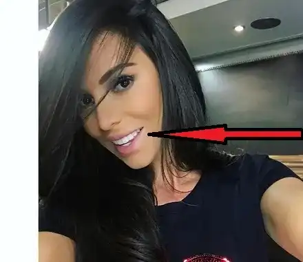 Алисия се похвали: Вижте ме, имам нови зъби! Кой го интересува? Ето как певицата изпадна в комична ситуация