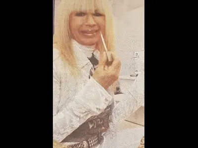 Лили Иванова изглади бръчки с лазер за 3 бона! Напомпа и джуки за ЧРД