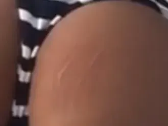 Моника, защо ни показа тази шокираща гледка? Валериева изтипоса дупе със странни белези в мрежата (ВИЖТЕ го отлблизо ТУК)