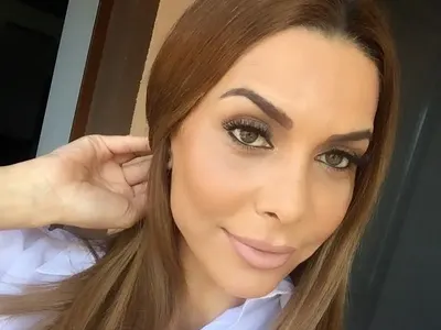 Бони легна под ножа! Оперираха носа й по спешност (Подробности)