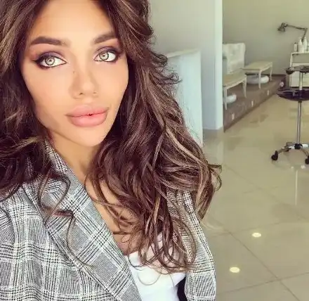 Есмер Омерова с трета пластика! (Новите й устни огромни)