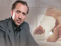 Никълъс Кейдж счупил крак при бой с колега заради жена