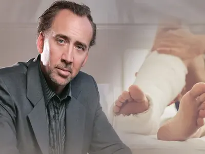 Никълъс Кейдж счупил крак при бой с колега заради жена