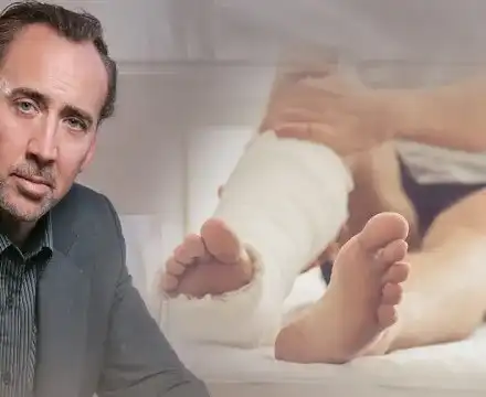 Никълъс Кейдж счупил крак при бой с колега заради жена