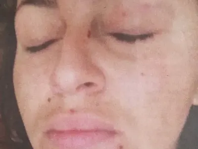 Дебора смляна от бой заради Фики, певицата живее в страх да не я залеят с киселина (Шокиращ разказ)