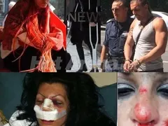 Миски и певици жертви на гаджета: Жана и Сани Алекса посинени от бой, краката на Деси Зидарова строшени с бухалка, Катрин Вачева със счупен нос