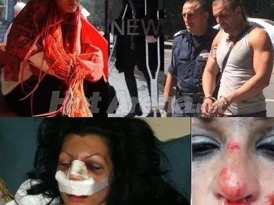 Миски и певици жертви на гаджета: Жана и Сани Алекса посинени от бой, краката на Деси Зидарова строшени с бухалка, Катрин Вачева със счупен нос